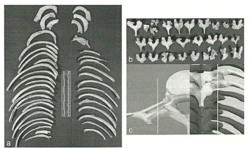Rib breakage and peeling marks on vertebrae recovered from Herxheim